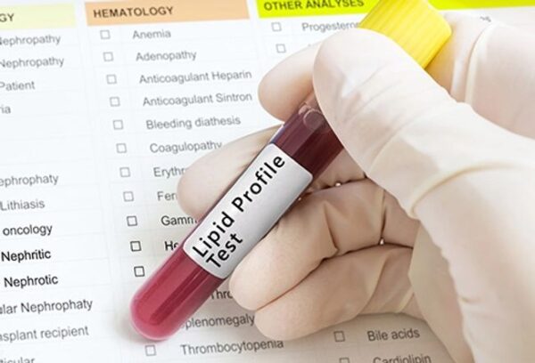 liver & kidney profile