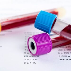hemogram (complete blood count)