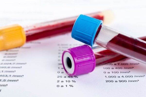 hemogram (complete blood count)