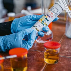 culture, urine with susceptibility